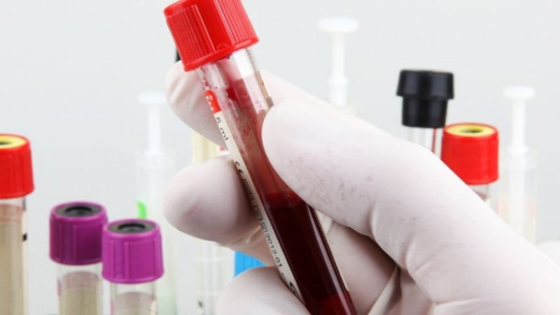 Kan aldırmak oruç bozar mı?